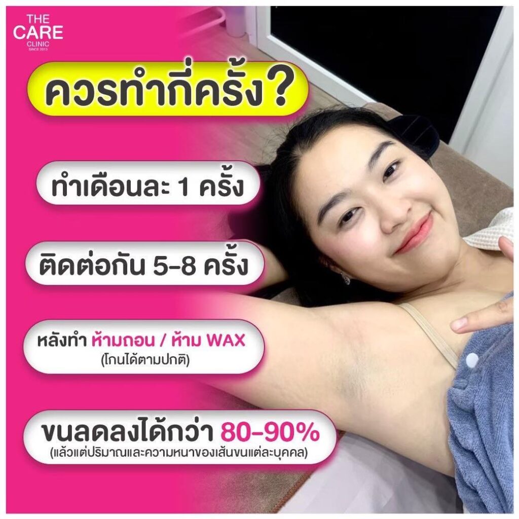 เลเซอร์กำจัดขนทำได้กี่ครั้ง