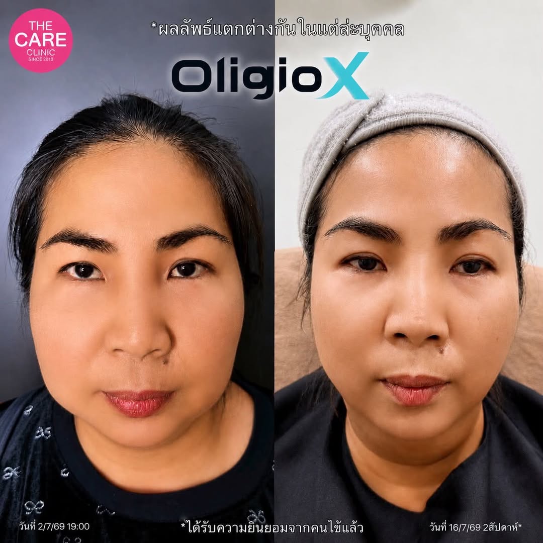 Review-OligioX2